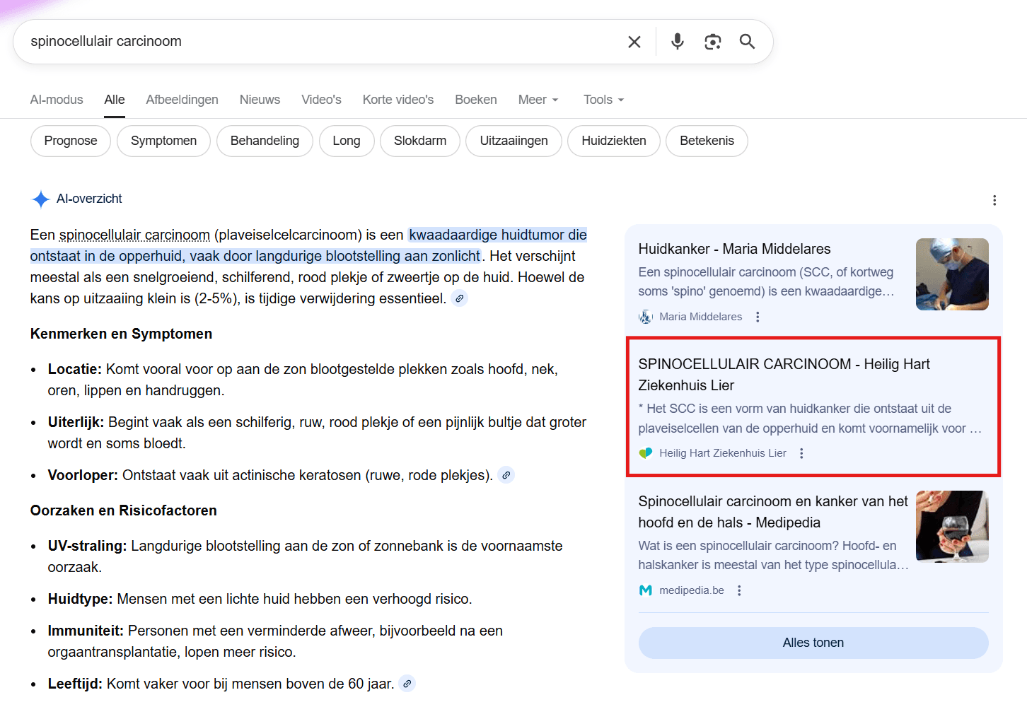heilighart ziekenhuis lier seo